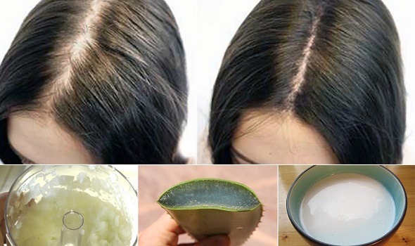 Best Home Remedies for Hair Fall in Pakistan (Stop Hair Loss Naturally)