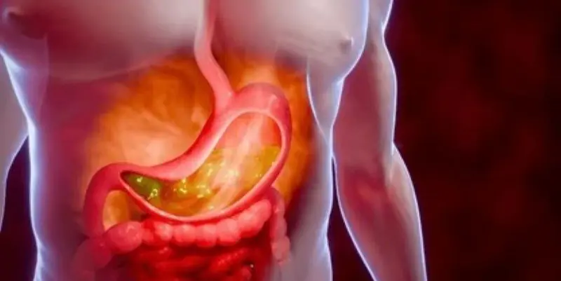 natural remedies for acidity at home