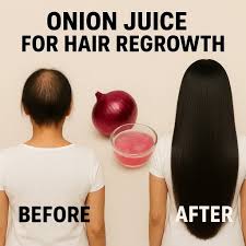 onion juice for hair fall before and after results onion juice for hair fall before and after results