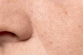 ice cube therapy for open pores treatment at home