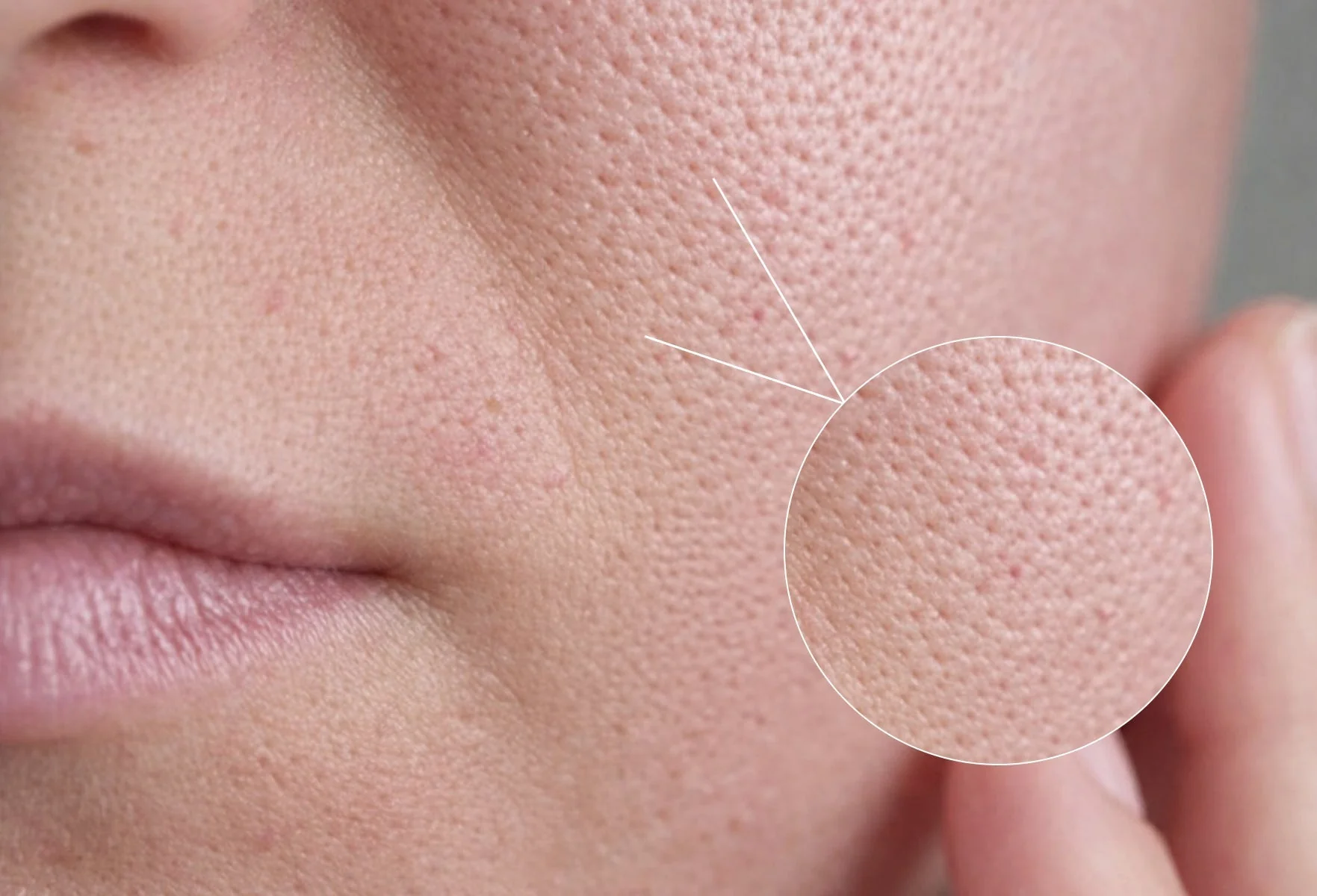1.	Homemade DIY face mask for open pores using natural ingredients