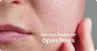 Natural ways to tighten skin pores fast at home Natural ways to tighten skin pores fast at home