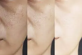 Natural ways to tighten skin pores fast at home