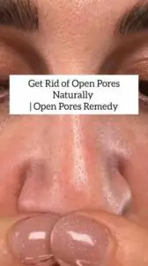 images - 2026-07-20T113524.361 Woman applying aloe vera gel as an overnight remedy for open pores.