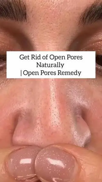 Woman applying aloe vera gel as an overnight remedy for open pores.